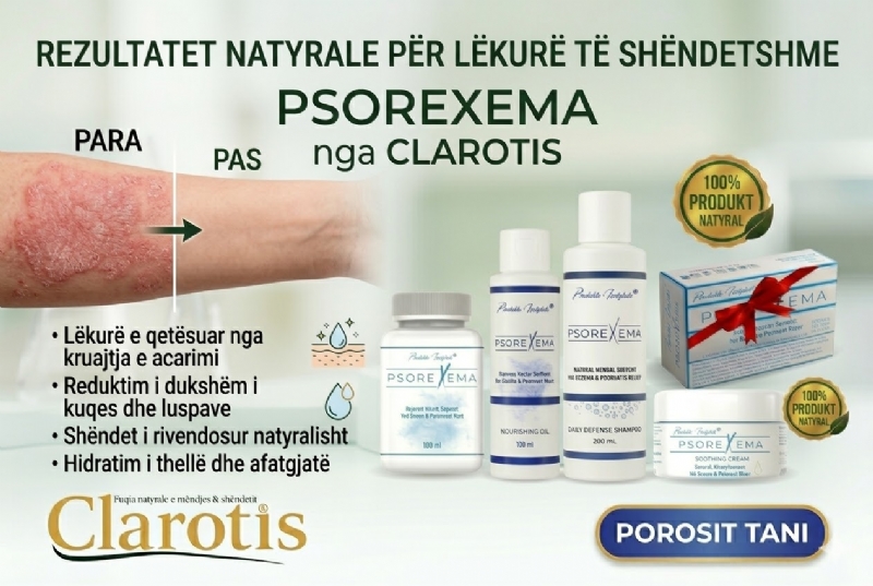 Krem per tharje lekure nga CLAROTIS, krem per psoriasis shqiperi, krem per ekzeme natyral, krem per lekure te demtuar, krem per trajtim lekure, krem hidratues, krem qetesues, krem per kruarje, sapuni psorexema, sapun natyral lekure