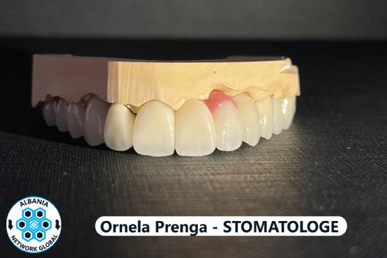 terapi dentare, kirurgji dentare, protetikë, kozmetikë dentare, ortodonc...