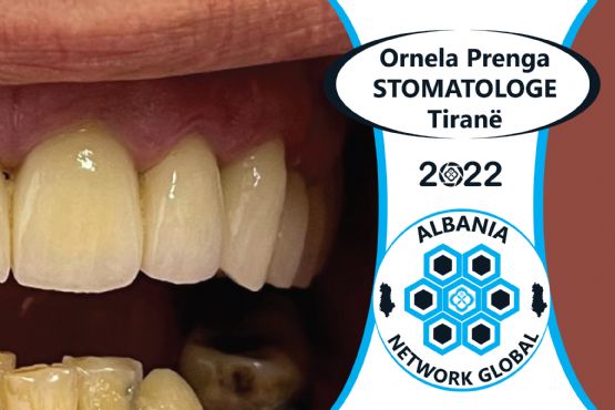 terapi dentare, kirurgji dentare, protetikë, kozmetikë dentare, ortodonci, implantologji